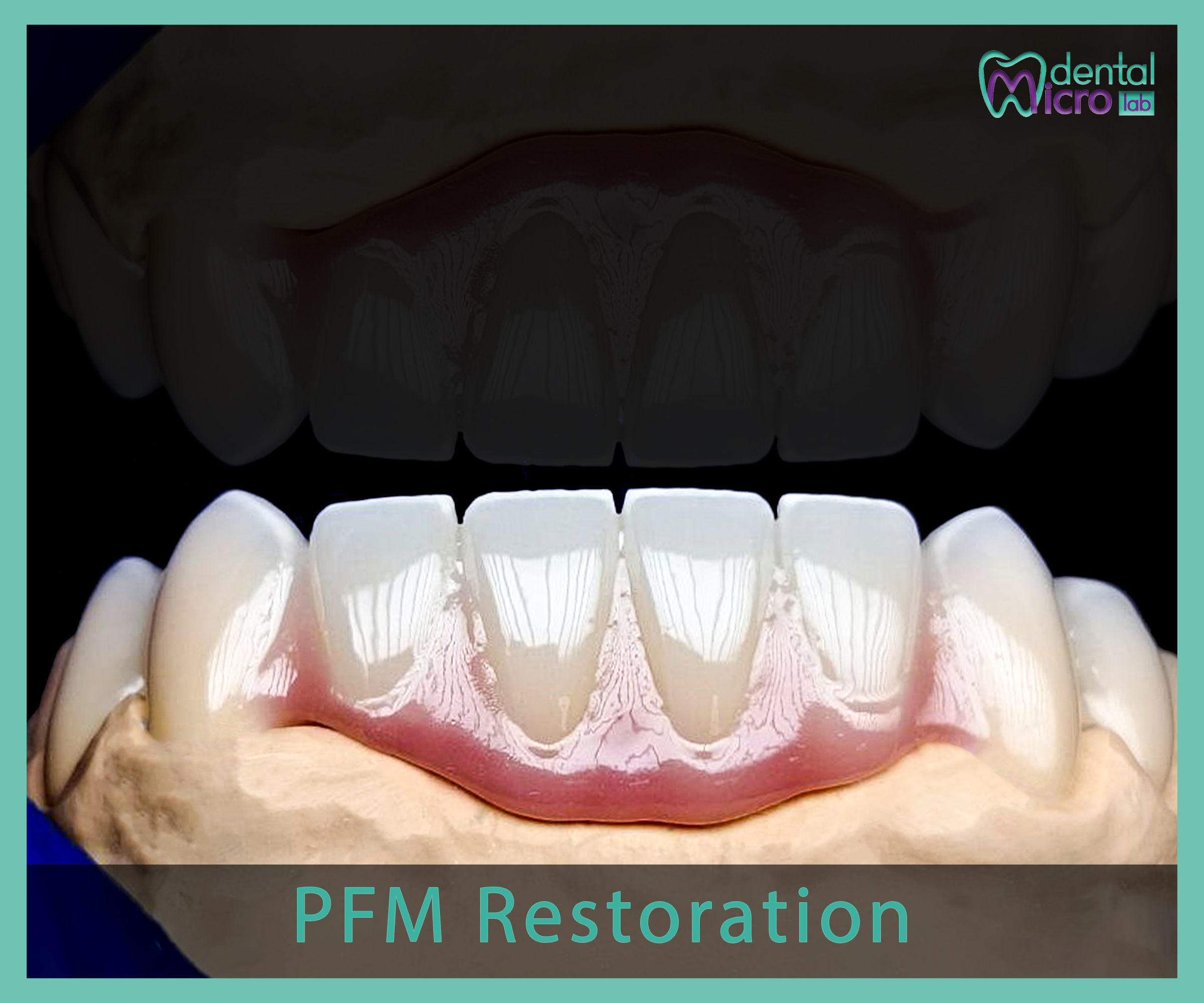 PFM- Jeddah - dental lab - افضل معمل في جدة تركيبات الاسنان للاطباء