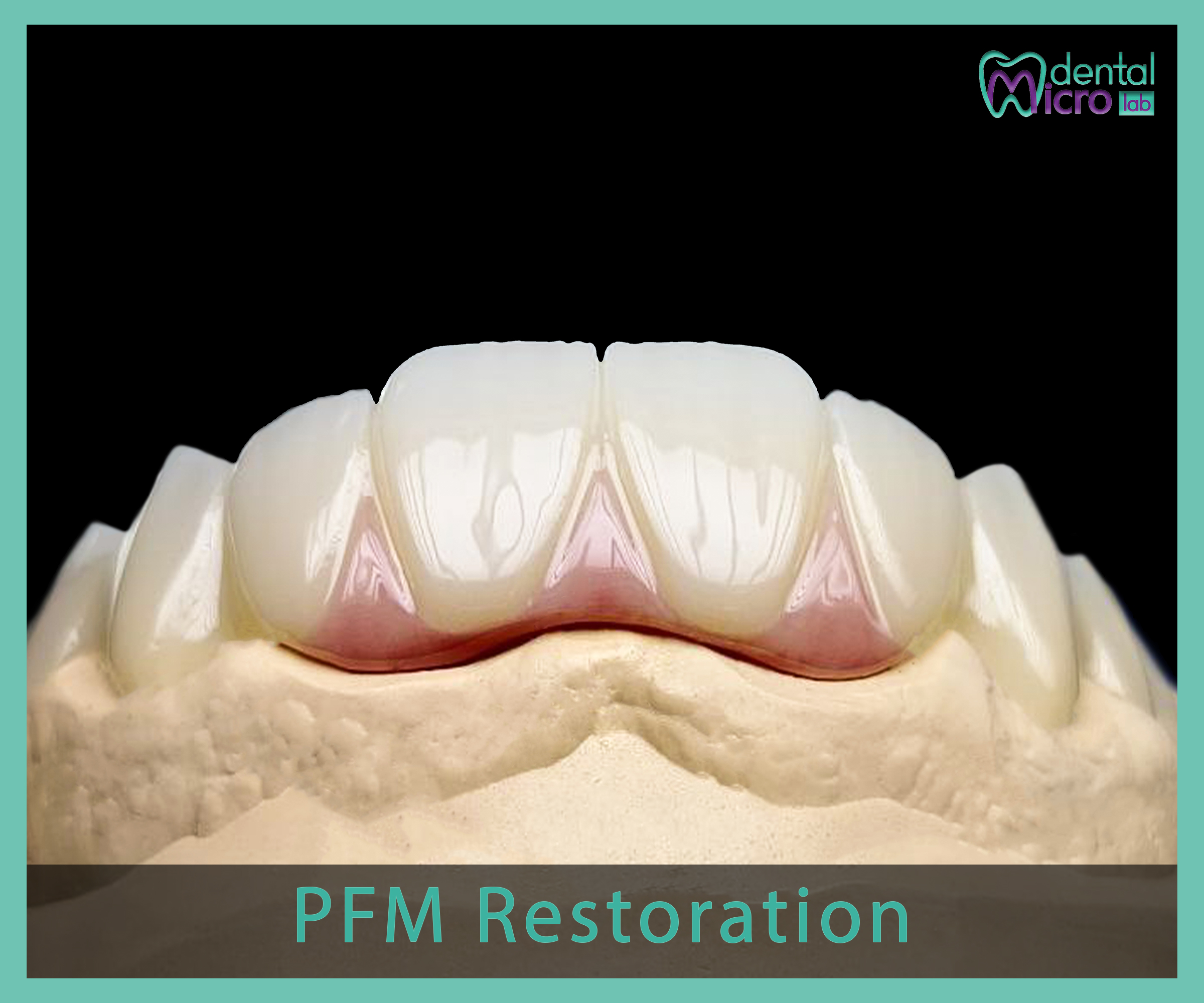 PFM- Jeddah - dental lab - افضل معمل في جدة تركيبات الاسنان للاطباء