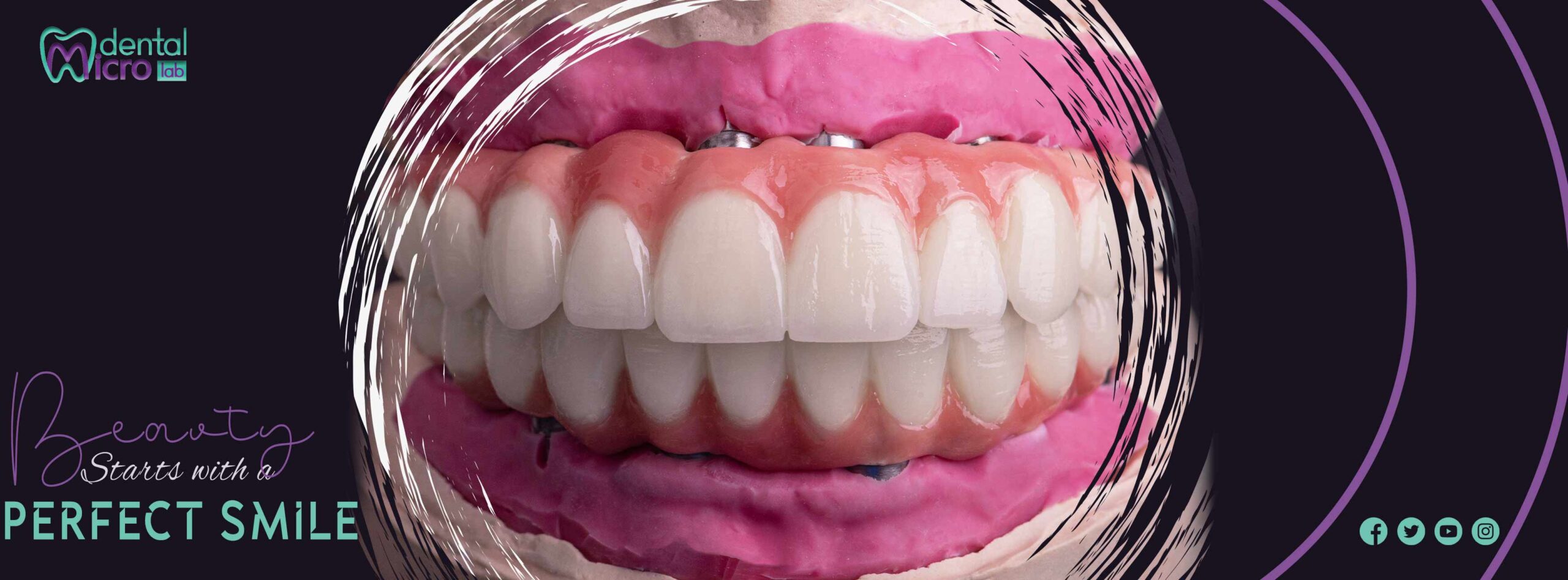 تركيبات إيماكس فينير إيماكس معمل أسنان جدة تركيبات تجميلية معمل تركيبات أسنان