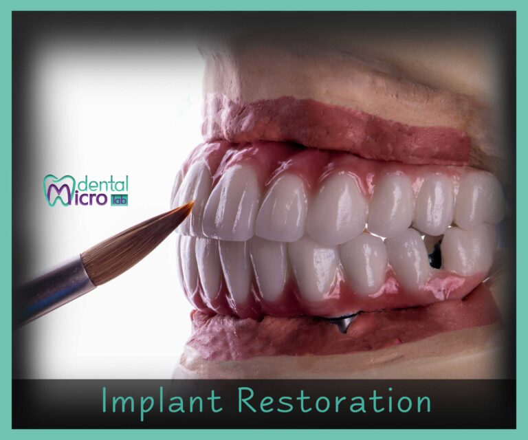 تركيبات إيماكس فينير إيماكس معمل أسنان جدة تركيبات تجميلية معمل تركيبات أسنان