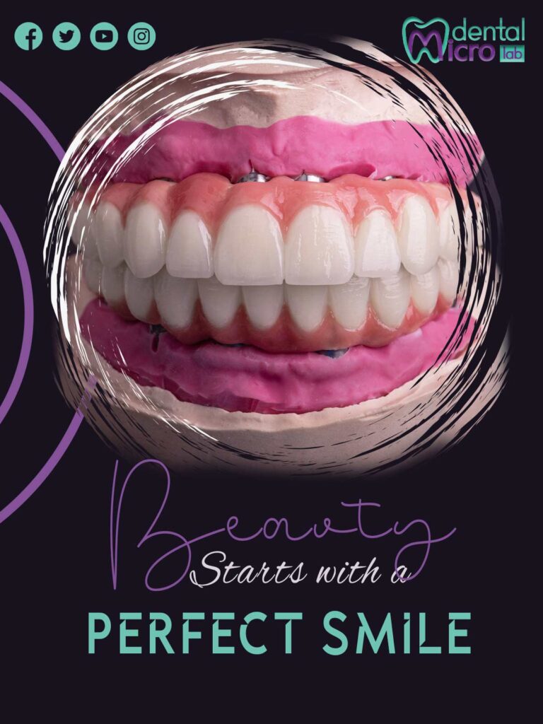 تركيبات إيماكس فينير إيماكس معمل أسنان جدة تركيبات تجميلية معمل تركيبات أسنان