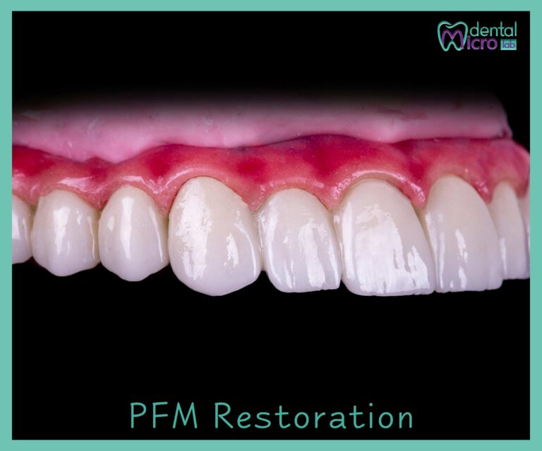 micro dental lab تركيبات زراعة الأسنان معمل زراعة الأسنان زراعة الأسنان في جدة تركيبات فوق الزرعات معمل أسنان جدة تركيبات تجميلية للأسنان dental emax