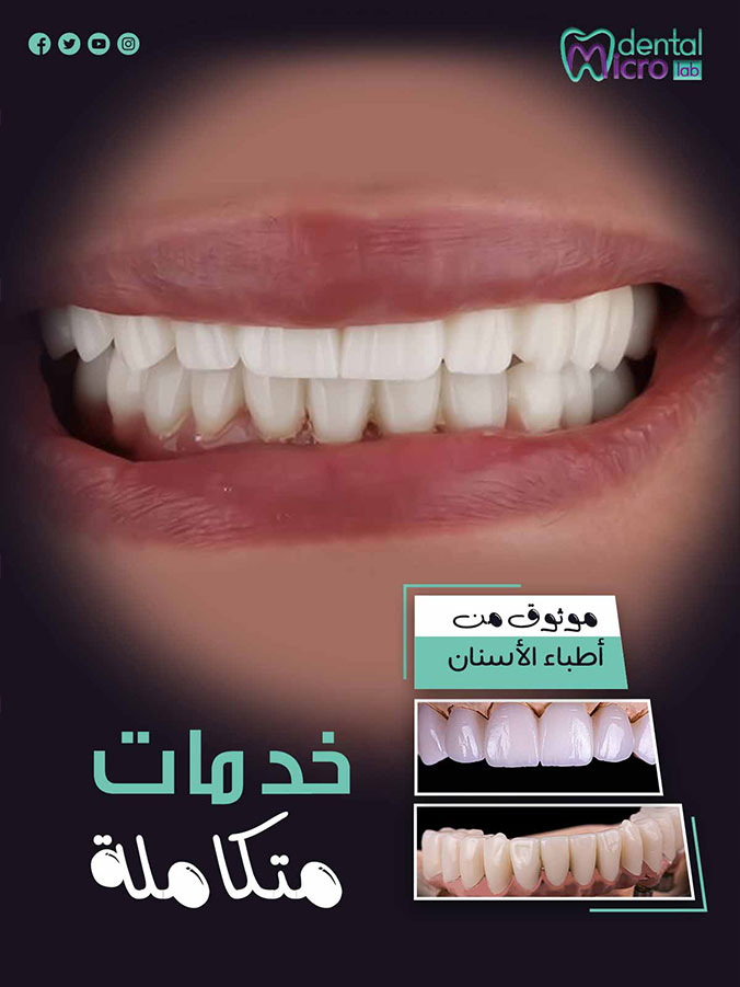 تركيبات إيماكس فينير إيماكس معمل أسنان جدة تركيبات تجميلية معمل تركيبات أسنان