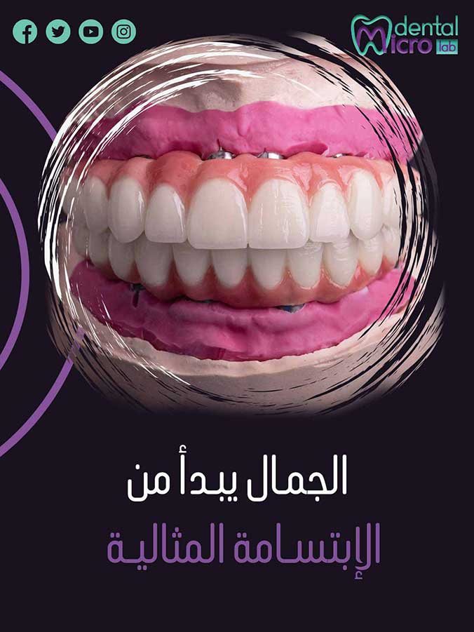 تركيبات إيماكس فينير إيماكس معمل أسنان جدة تركيبات تجميلية معمل تركيبات أسنان