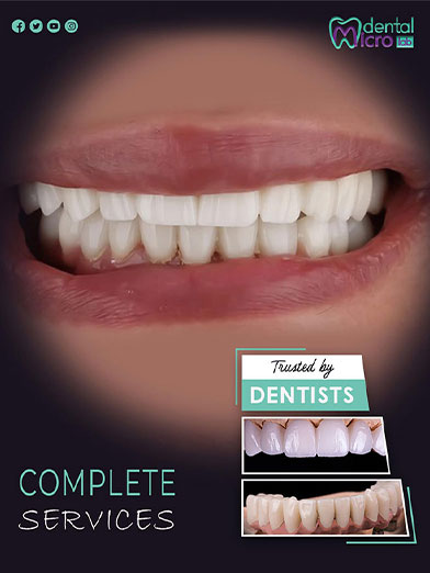 تركيبات إيماكس فينير إيماكس معمل أسنان جدة تركيبات تجميلية معمل تركيبات أسنان